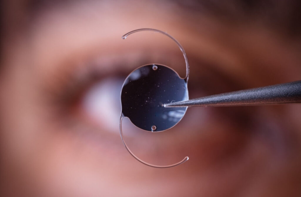 A close-up image of an intraocular lens to be inserted after the natural lens is removed during cataract surgery.